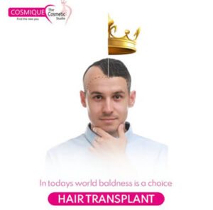 HairTransplant-HairLoss-Treatment
