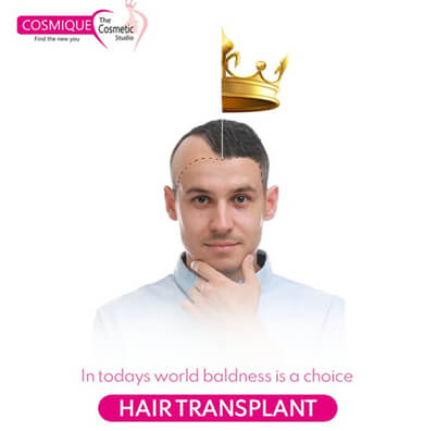 HairTransplant-HairLoss-Treatment